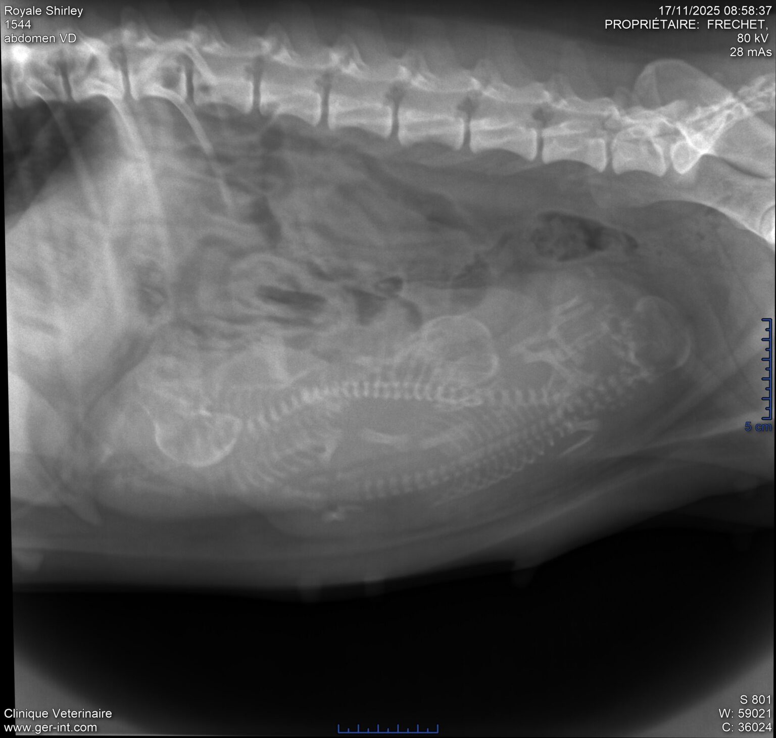 Royale shi 2025 11 17 08 58 37 abdomen vd (1)